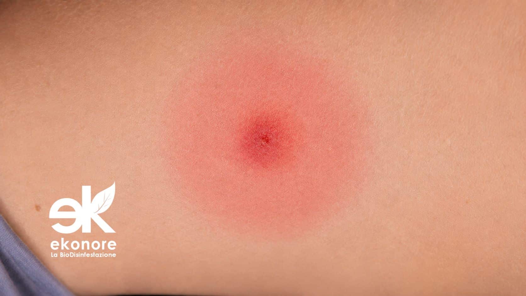 bio disinfestazione punture zecche e acari del piccione bio disinfestazione punture zecche e acari del piccione